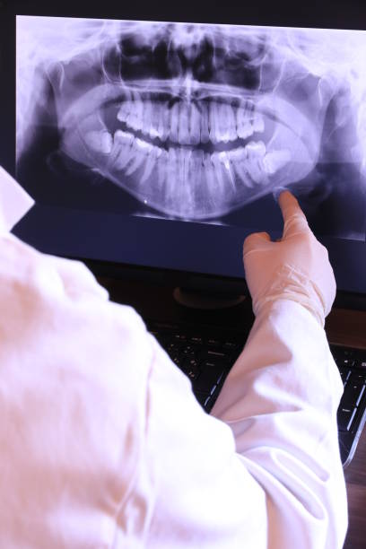 Best Emergency Root Canal Treatment in Bertram, TX