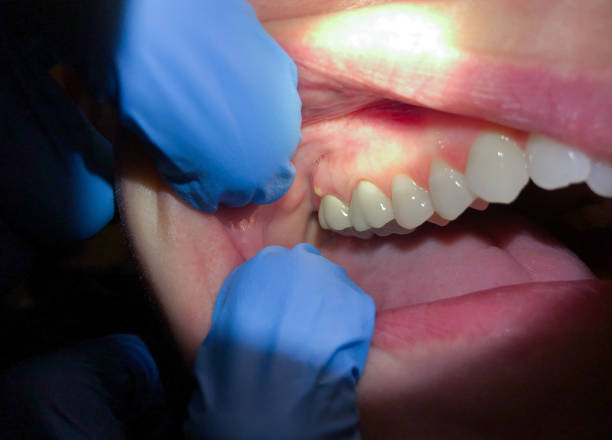 Best Holiday Emergency Dentist in Bertram, TX